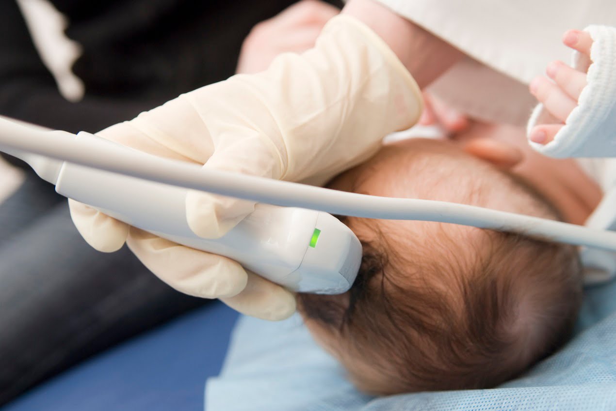 Badanie ultrasomografem głowy dziecka